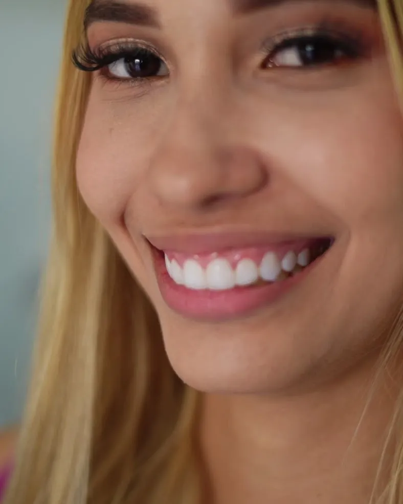 Mulher sorrindo com dentes claros e alinhados